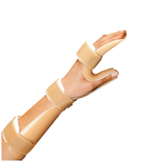 NΑΡΘΗΚΑΣ ΑΝΑΠΑΥΣΗΣ 'RESTING SPLINT'